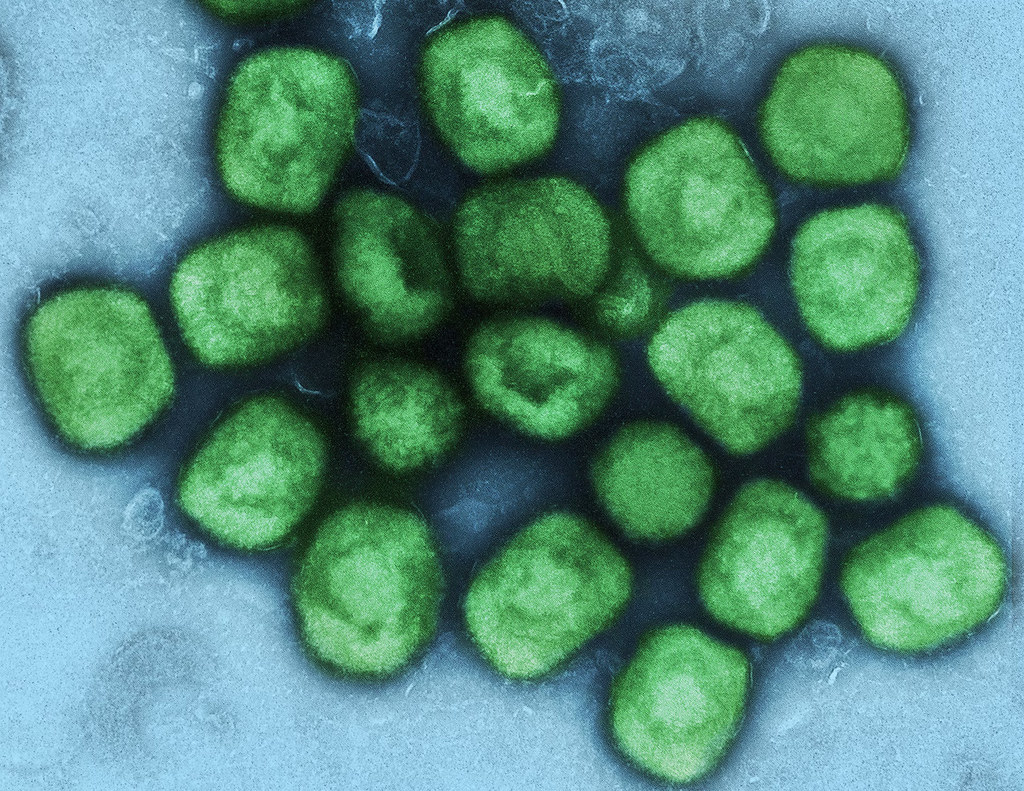 Colorized transmission electron micrograph of monkeypox virus particles (green) cultivated and purified from cell culture. Image captured at the NIAID Integrated Research Facility (IRF) in Fort Detrick, Maryland. Credit: NIAID