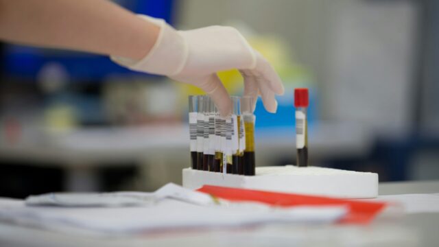 Image of person with a gloved hand picking up vials containing blood samples