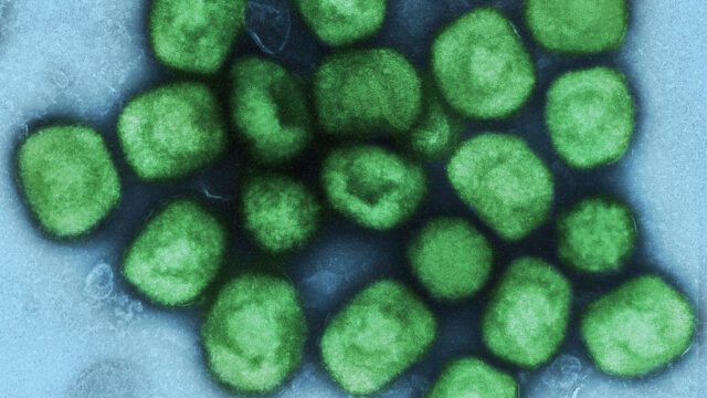 Colorized transmission electron micrograph of monkeypox virus particles (green) cultivated and purified from cell culture. Image captured at the NIAID Integrated Research Facility (IRF) in Fort Detrick, Maryland. Credit: NIAID